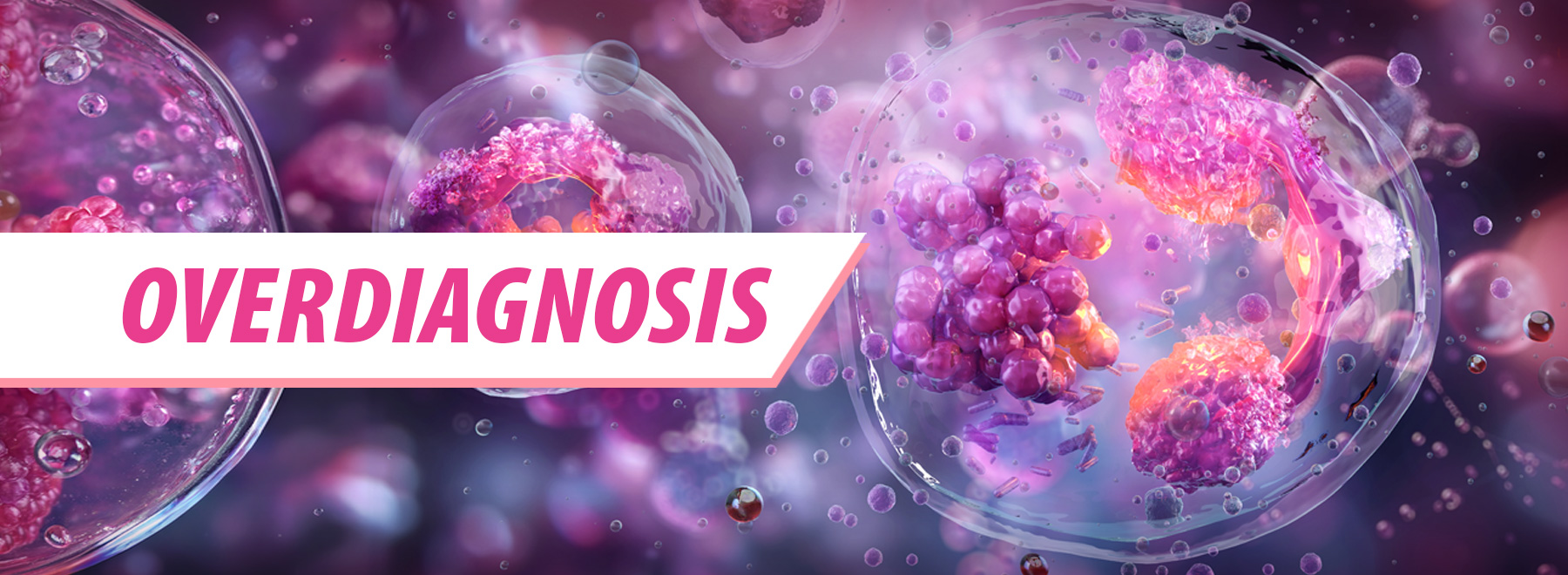 Cells illustrating POTS overdiagnosis, highlighting misdiagnosis in autonomic nervous system disorders.